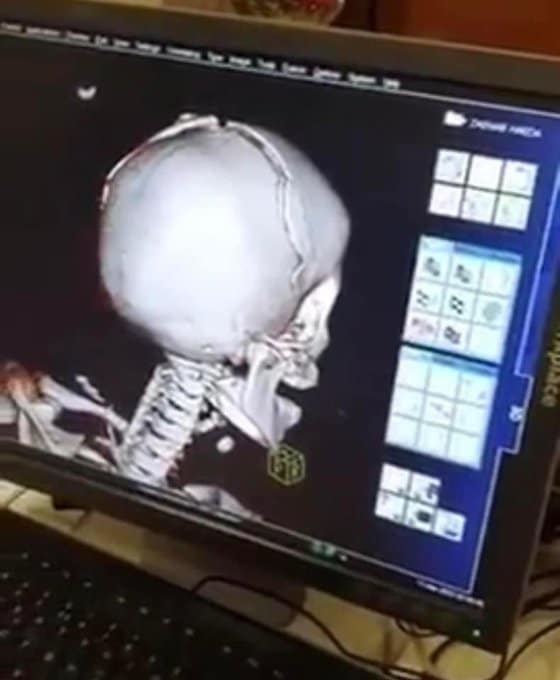 الطفلة زينب