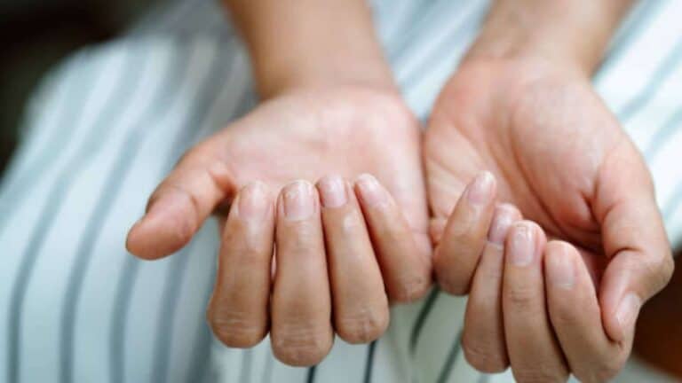 هذه العلامة في الأظافر دليل خطير على وجود مشكلة في القلب! watanserb.com