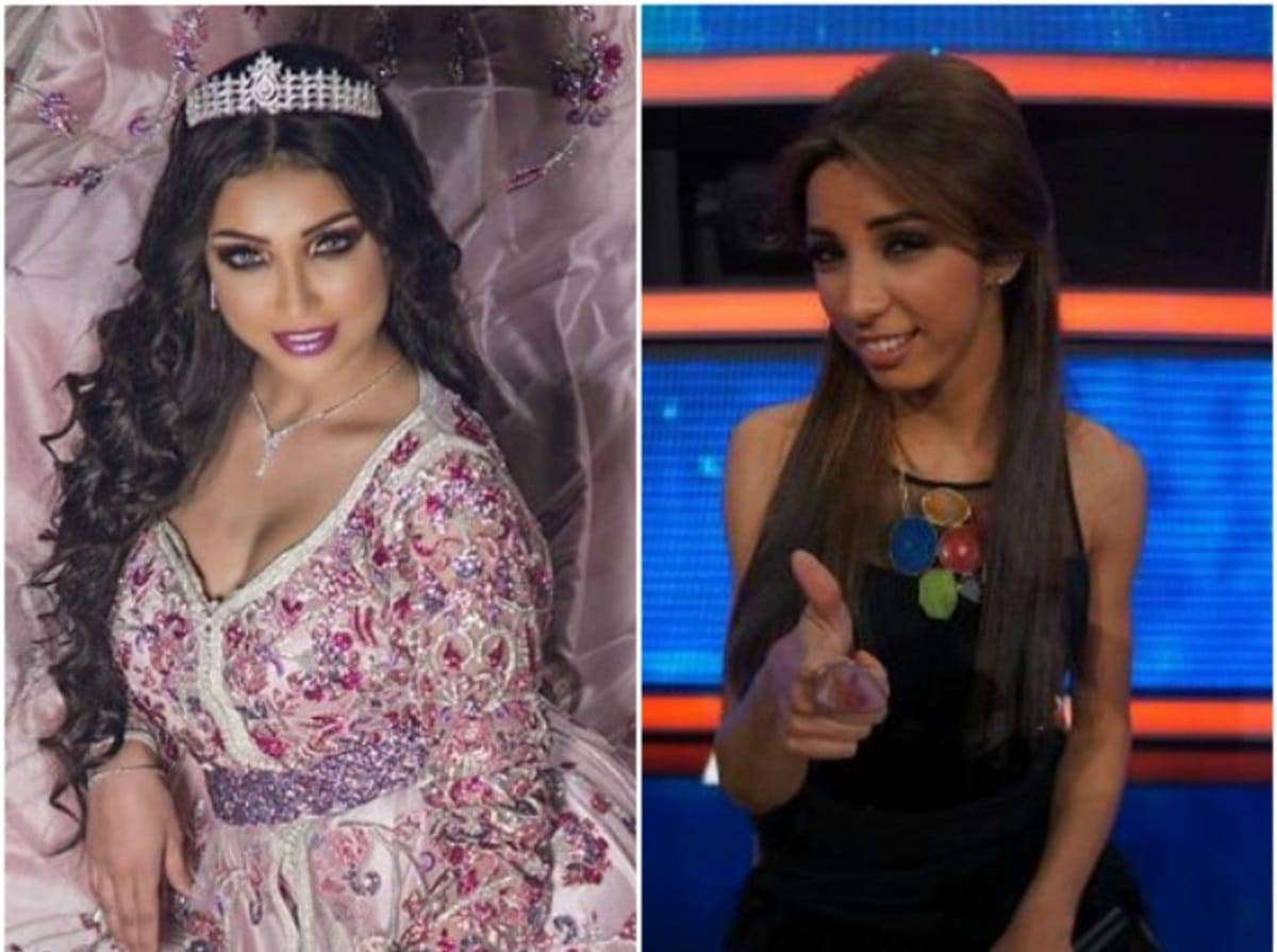 دنيا بطمة قبل وبعد