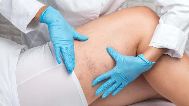 الدوالي.. 6 أعراض لا يجب أن تتجاهلها! watanserb.com