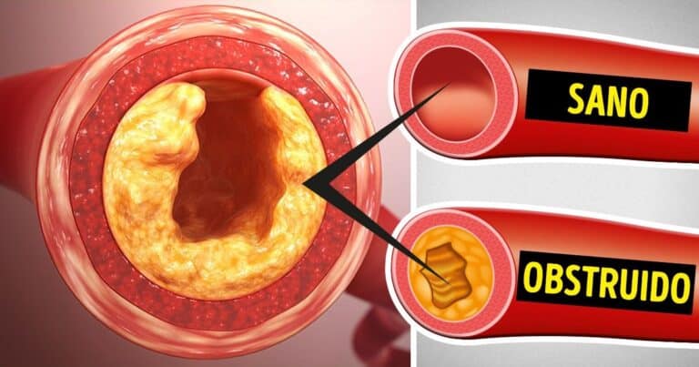 6 أطعمة خطرة يمكن أن تسد الشرايين watanserb.com