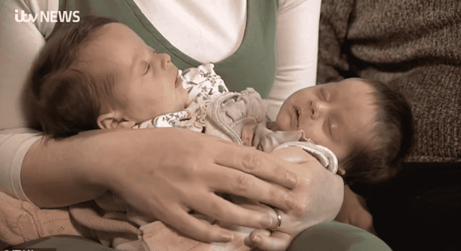 توأمين ملتصقين watanserb.com