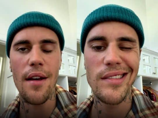 إصابة جاستن بيبر بشلل في الوجه بسبب متلازمة رامزي هانت watanserb.com