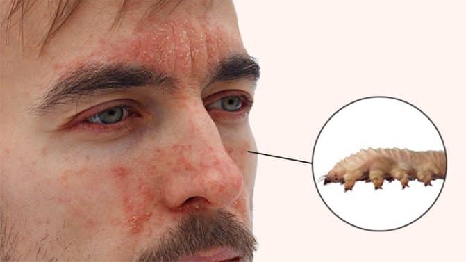 العث يمارس الجنس على وجه البشر watanserb.com