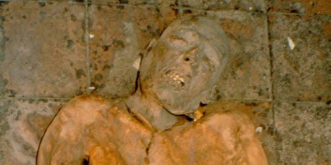 ما نتيجة استخدام علماء حصوة مرارة من جثة محنطة لأمير إيطالي من القرن 16! (صور) استخدام علماء حصوة مرارة من جثة محنطة لأمير إيطالي من القرن 16 watanserb.com