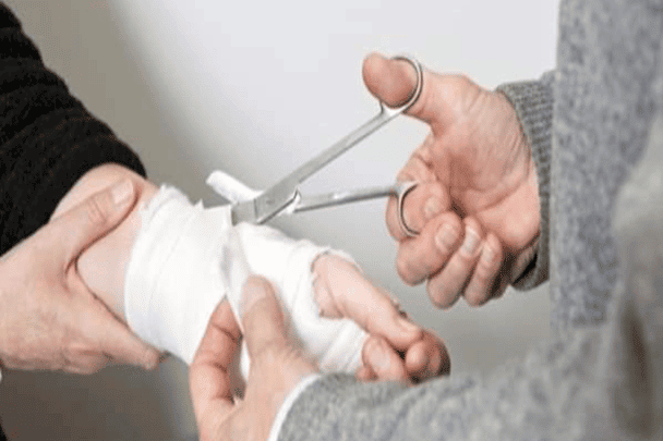 أسرار مداواة الحروق watanserb.com