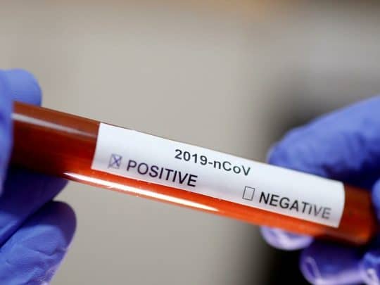 بعد تحصين نفسها لعامين ونصف.. “كورونا” يصل آخر دولة في العالم آخر دولة يصل إليها فيروس كورونا watanserb.com