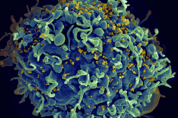 مرض الإيدز watanserb.com