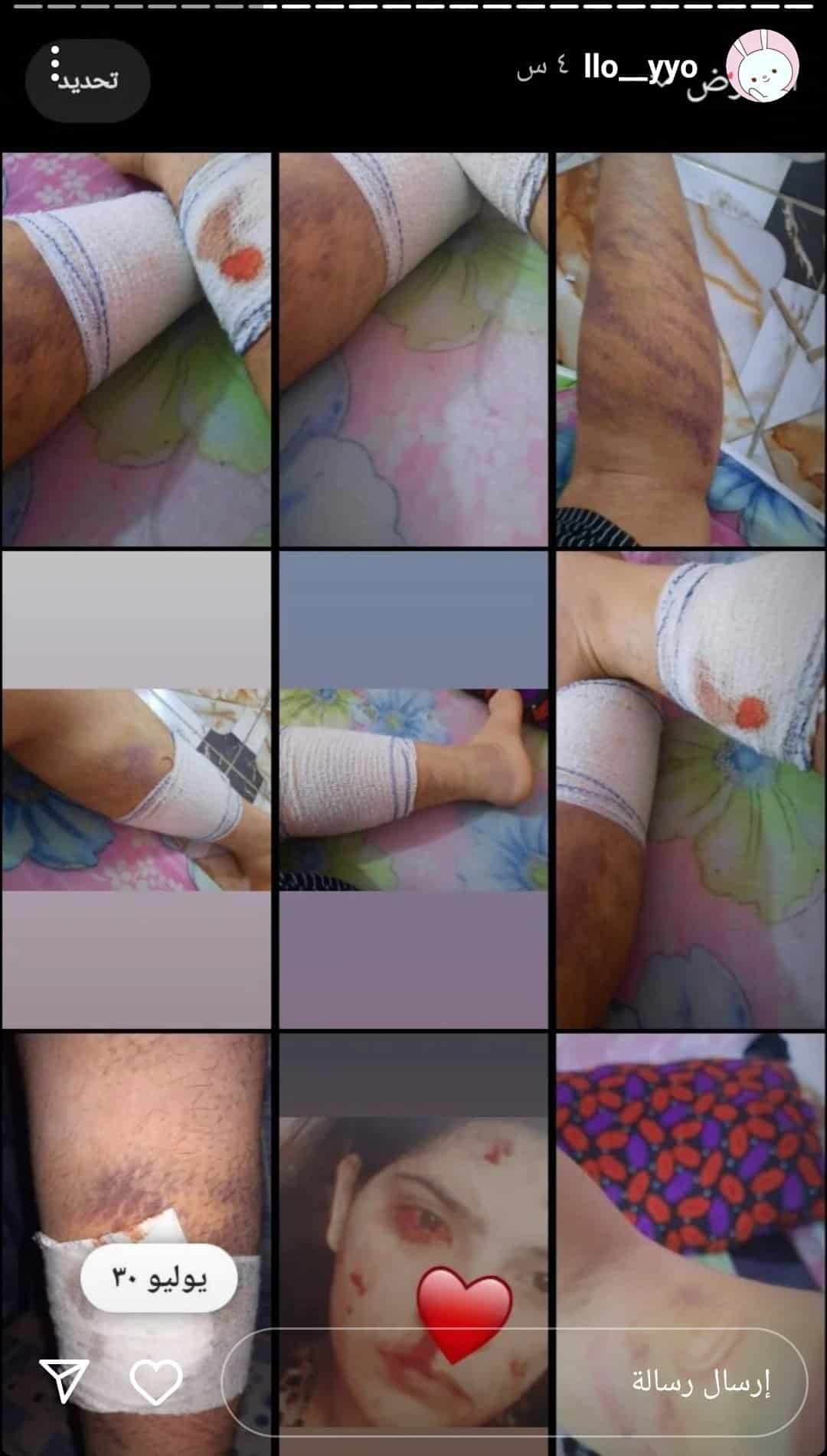 آية الموسوي