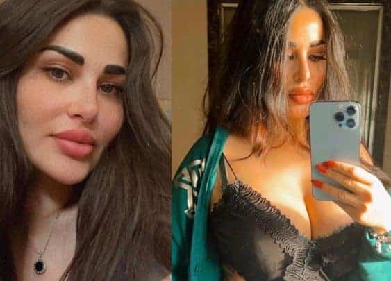 ندى الكامل توضح حقيقة تساؤلات حول تشوه وجهها واتهامات بالحرق بسبب الحساسية طليقة أحمد الفيشاوي بوجه مشوَّه.. هل تعرضت للحرق؟ (شاهد) watanserb.com