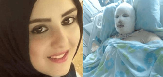هناء خضر.. لبنانية أحرقها زوجها حتى الموت وهي حامل! watanserb.com