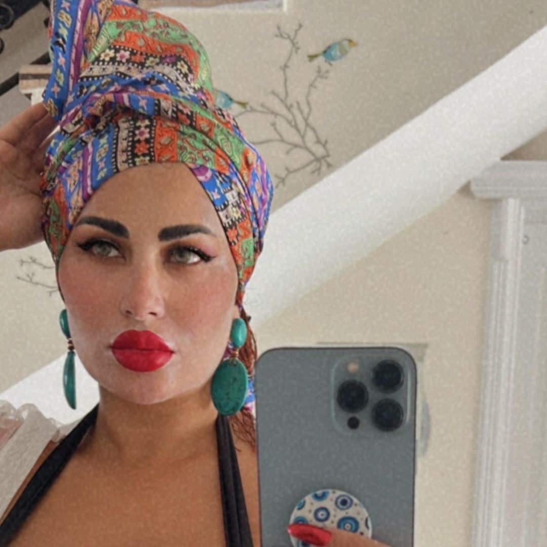 طليقة أحمد الفيشاوي