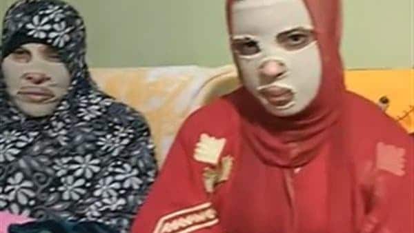 شاب مصري يشوه وجه فتاة بـ”مياه النار” لرفضها الزواج منها (صور مأساوية) شاب يشوه وجه فتاة رفضت الزواج منه watanserb.com