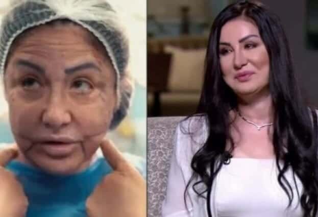 وفاء سالم.. شاهد جمالها قبل تشويه وجهها على يد طبيب تجميل بلا ضمير! وفاء سالم.. شاهد جمالها قبل تشويه وجهها على يد طبيب تجميل بلا ضمير! watanserb.com