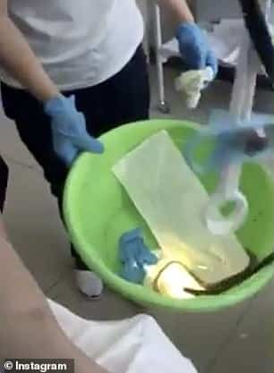 ثعبان في جسد سيدة