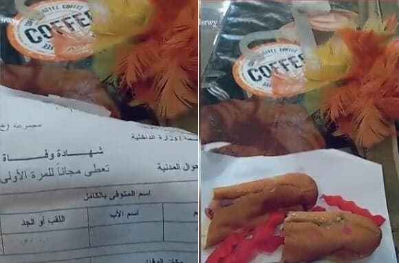 شهادة وفاة على “ساندوتش كبدة” تثير ذهول المصريين.. ما القصة؟ شهادة وفاة على ساندوتش كبدة watanserb.com