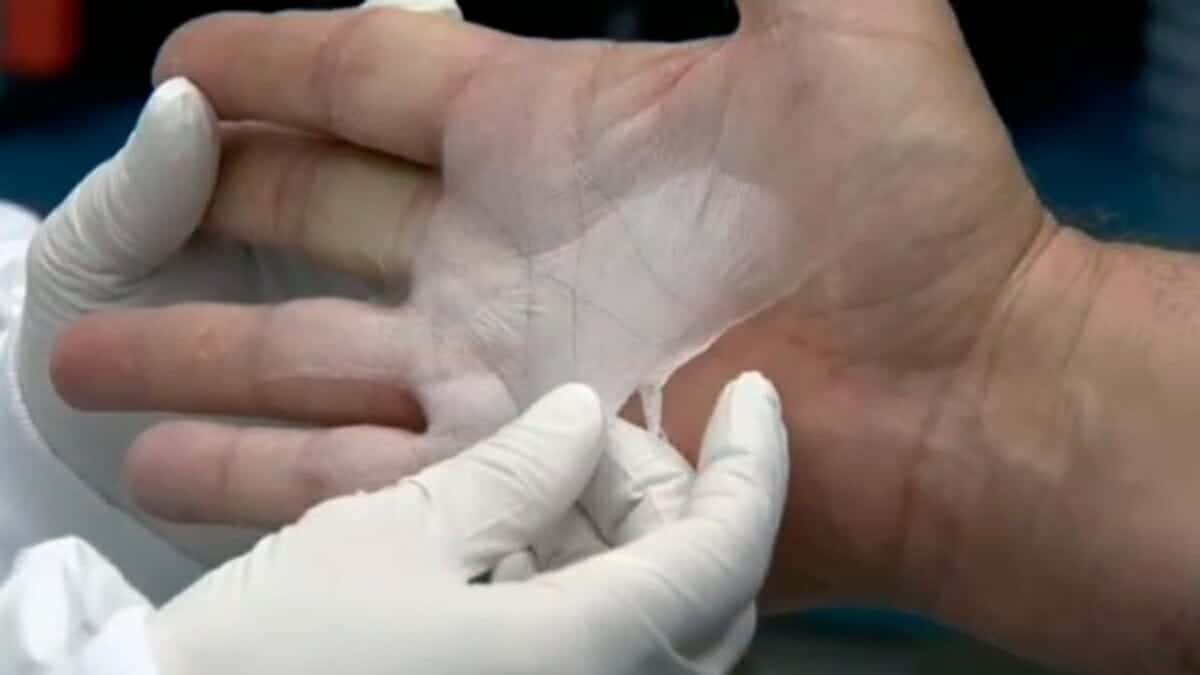 يجب أن يكون الجلد قادرًا على إعادة إنشاء جميع وظائف الجلد، مثل الحماية من التهديدات الخارجية أو التنظيم الحراري".