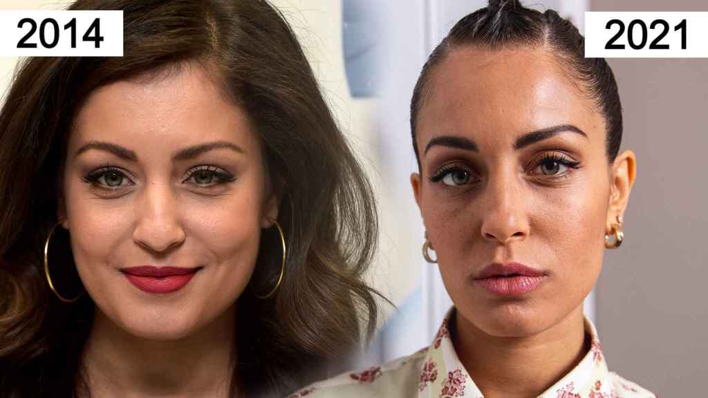 هبة عبوك قبل وبعد