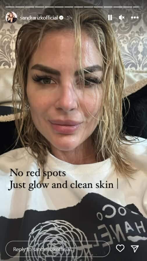 ساندرا رزق بدون مكياج