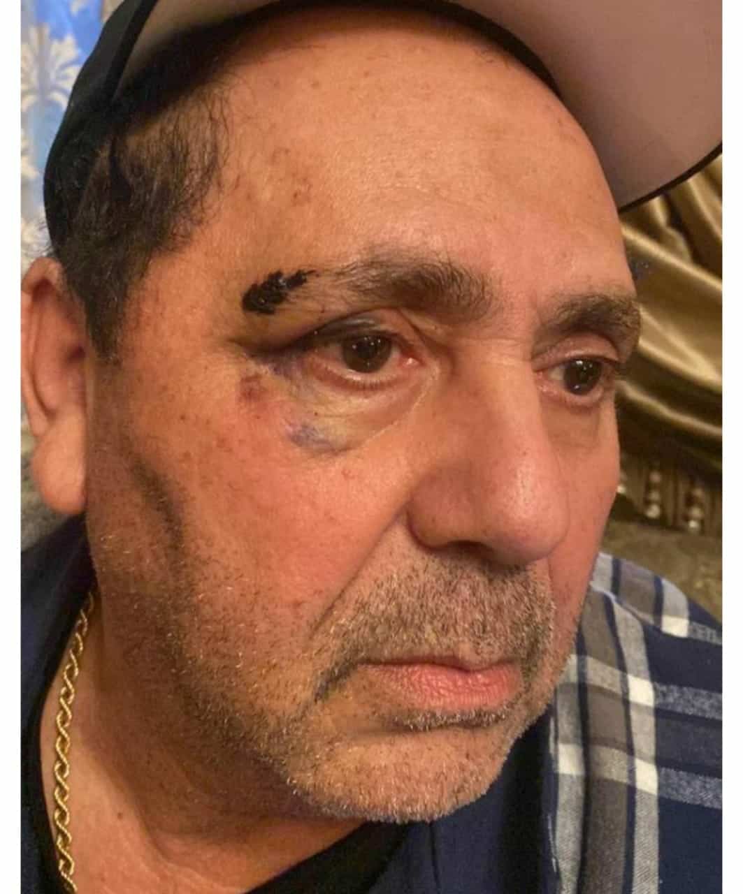 صور شاركها عبدالعزيز لبيب من آثار الاعتداء عليه