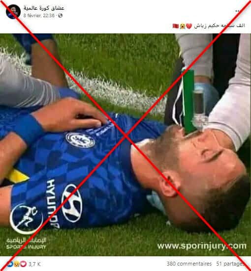 إصابة حكيم زياش مع نادي تشيلسي