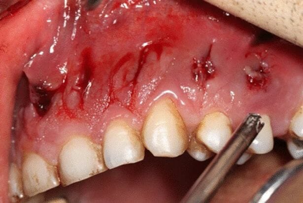 انتشر المرض النادر في وجهه