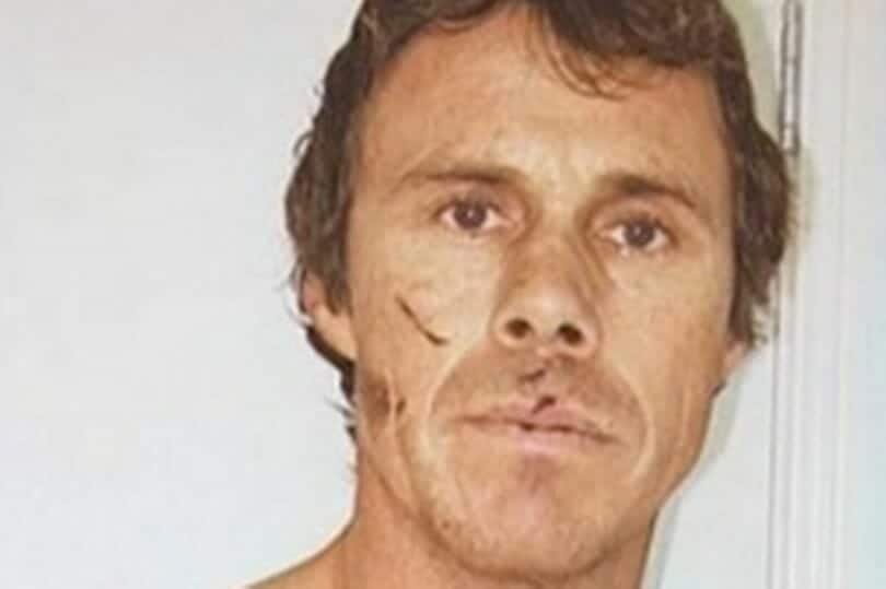 الغواص الذي تم الهجوم عليه من قبل سمكة قرش