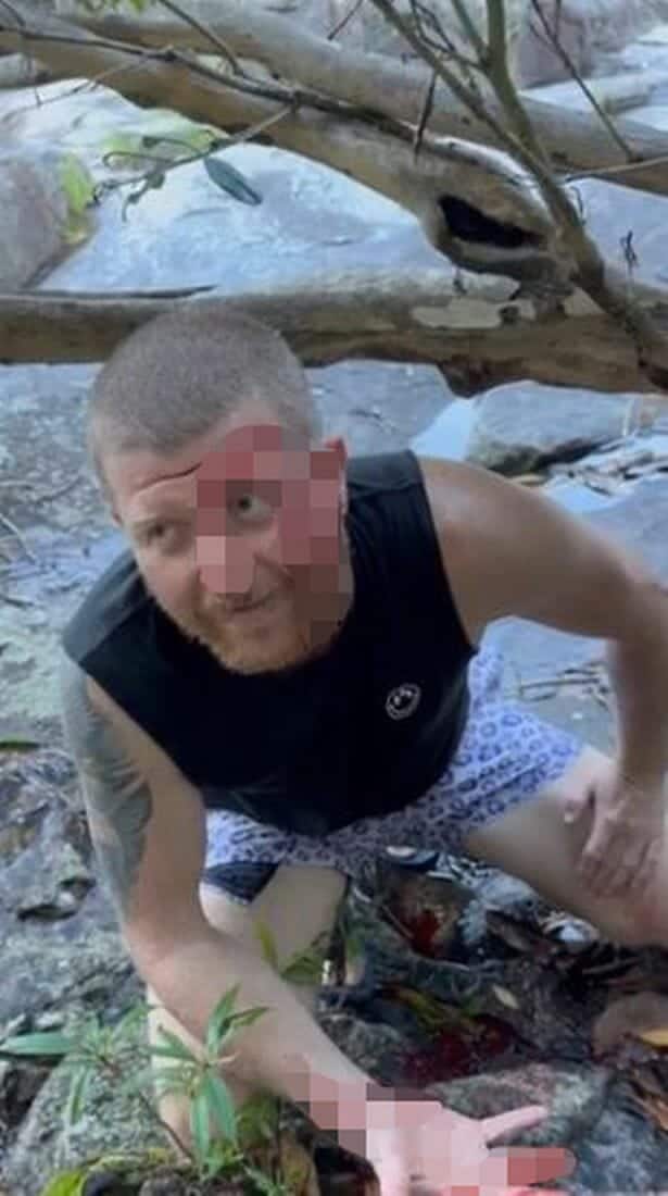 ثعبان يعض رجلا