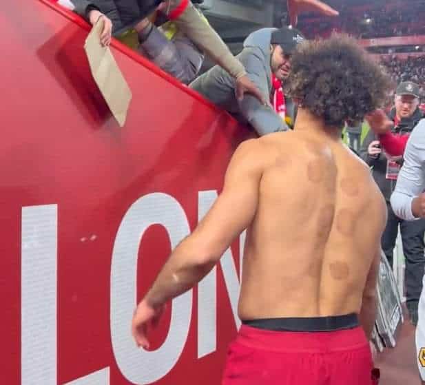 حجامة محمد صلاح في ظهره