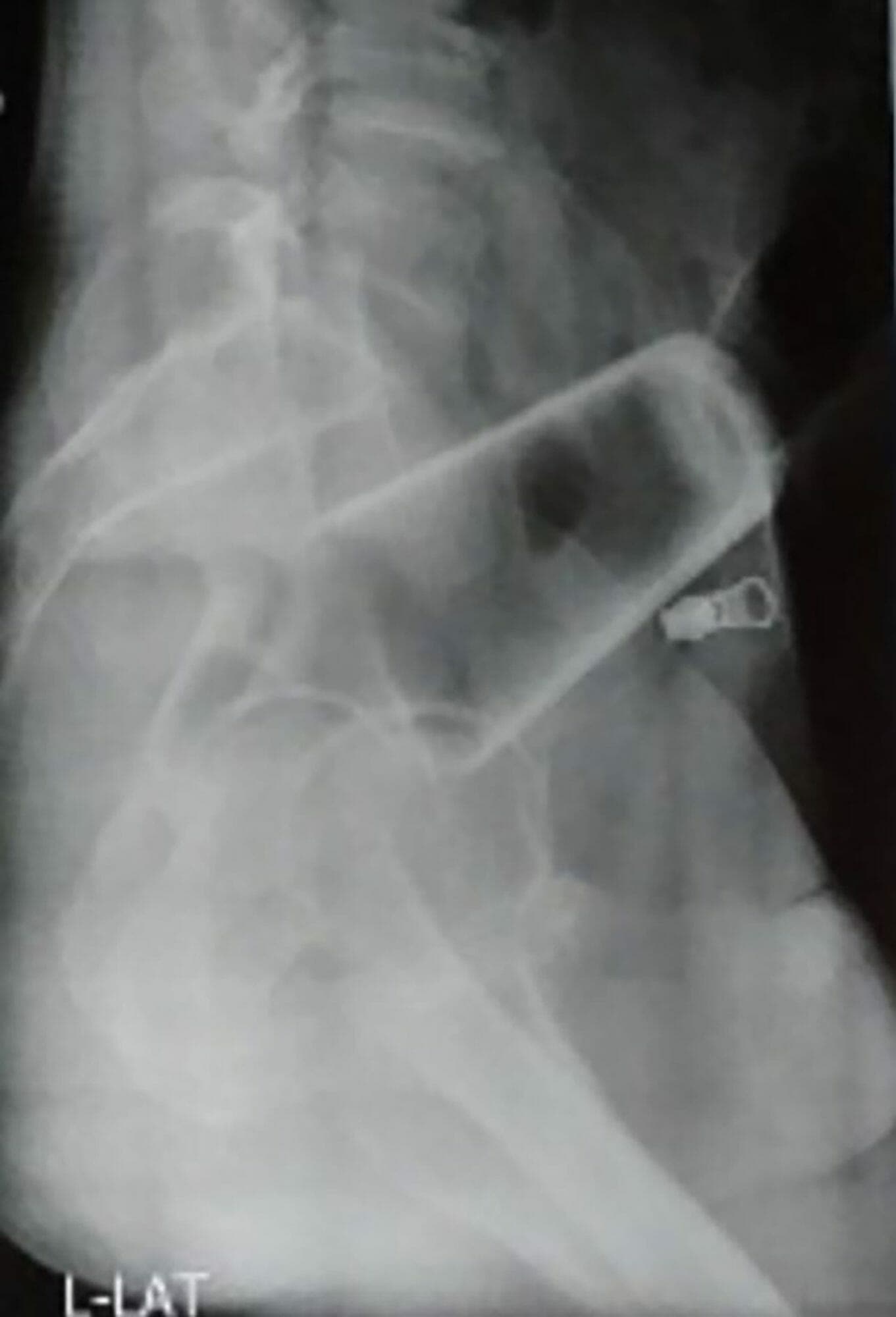 ممارسة الجنس مع كأس زجاجي