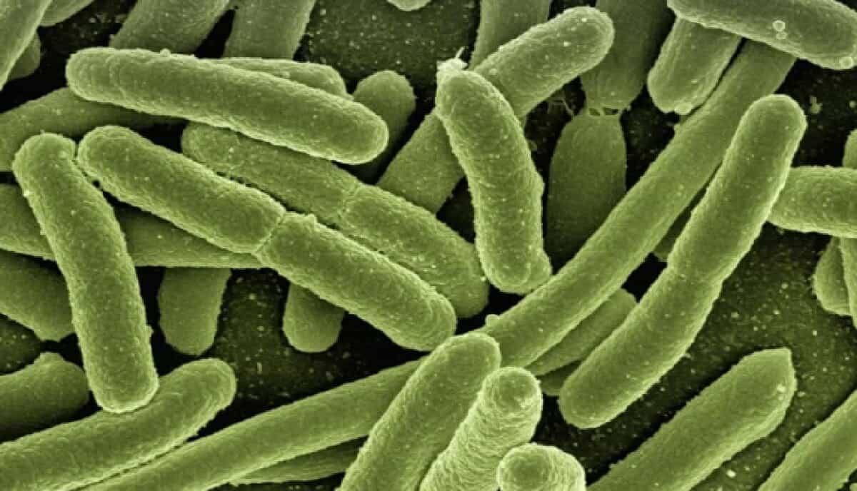 هذه هي البكتيريا التي لا تستجيب للمضادات الحيوية البكتيريا التي لا تستجيب للمضادات الحيوية watanserb.com