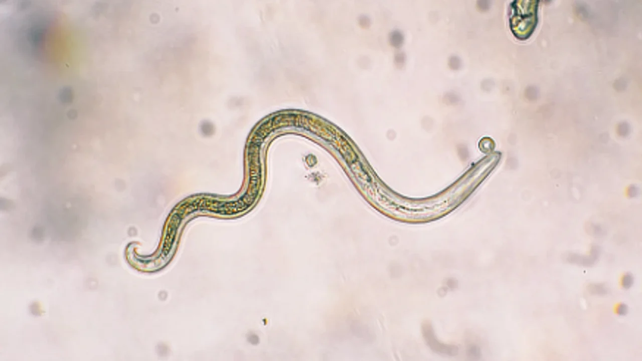 الديدان تزحف تحت جلده..عامل إسباني يصاب بحالة نادرة جداََ (صور) الديدان تزحف تحت جلده..عامل إسباني يصيب بحالة نادرة جداََ (صور) watanserb.com