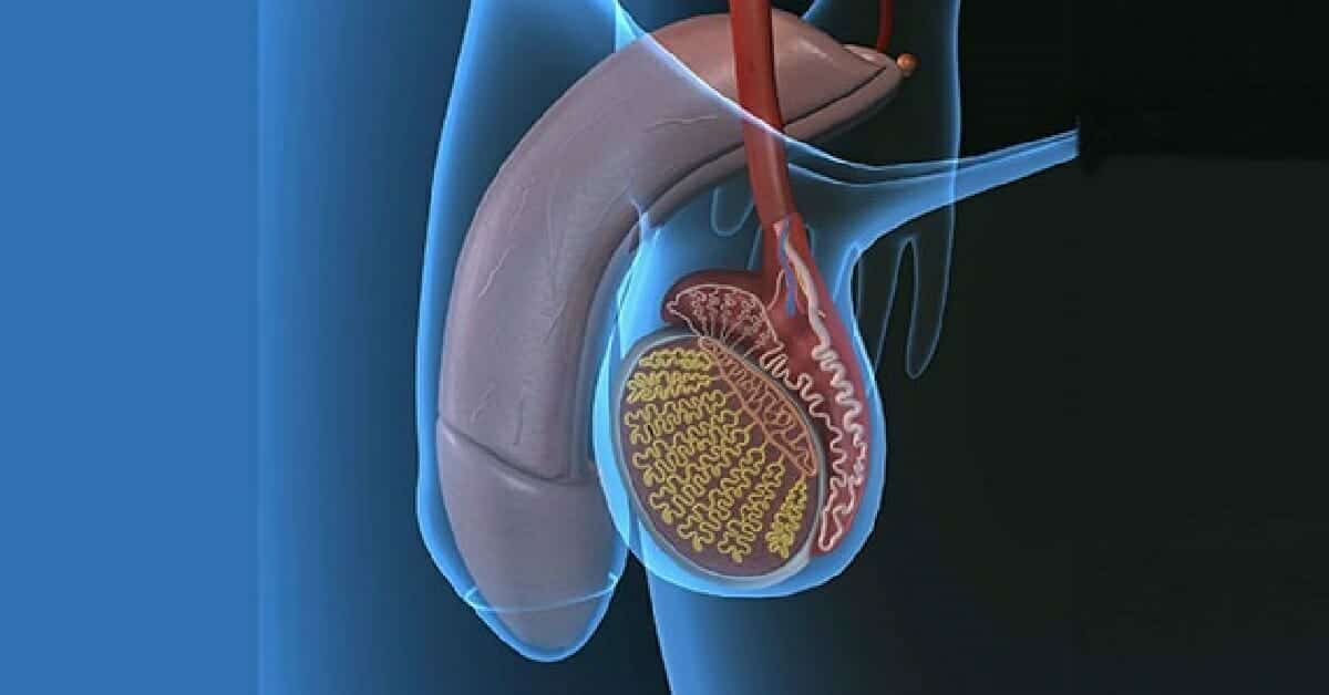 مرض التهاب الخصيتين