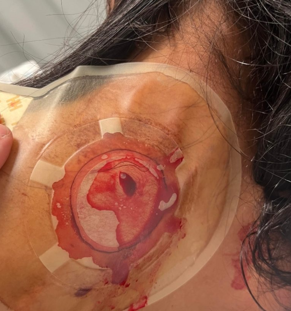 طعن غدير الفهد