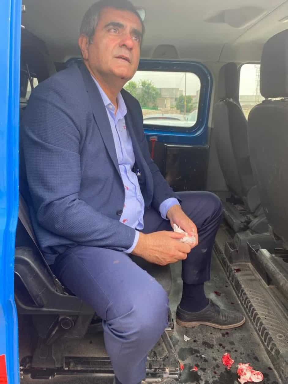 ضرب نائب سابق عن حزب الشعب الجمهوري