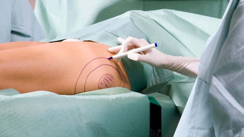 تكبير المؤخرة