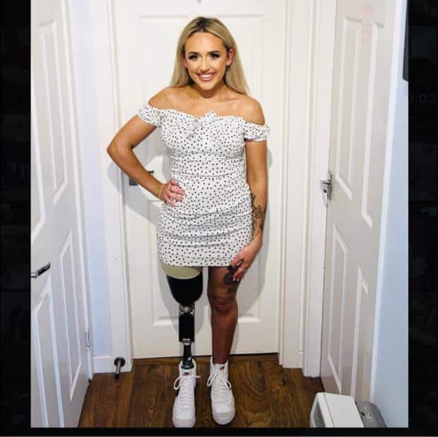 تستخدم ساق صناعية بعد أن فقدت ساقها أثناء معركتها ضد السرطان