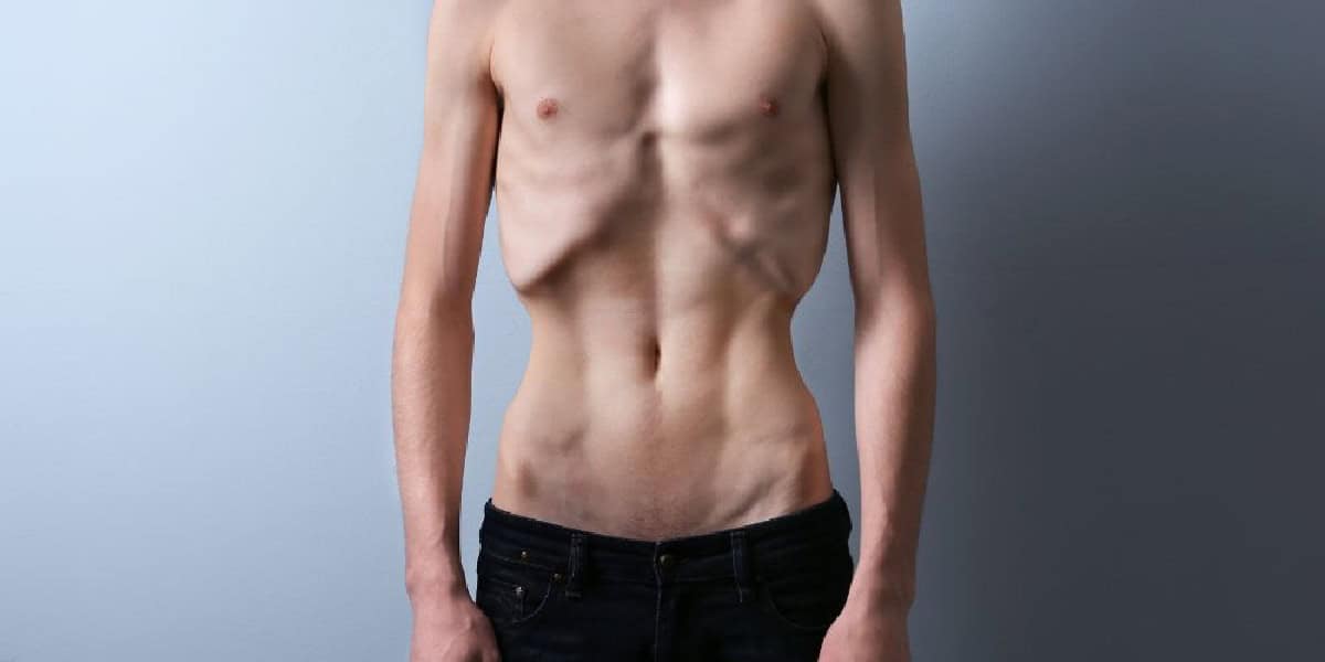 العلاج بالسيلوسيبين يمكن استخدامه لعلاج فقدان الشهية العصبي