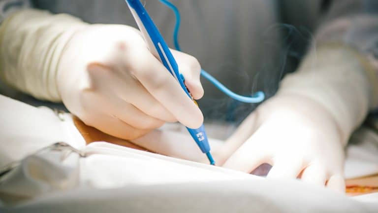 قدرة فيروس الإيبولا على إحداث عدوى مزمنة