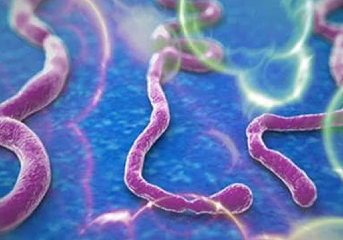 “فيروس قاتل” ينتشر في ولايات جزائرية والسلطات توضح! "فيروس قاتل" ينتشر في ولايات جزائرية والسلطات توضح!