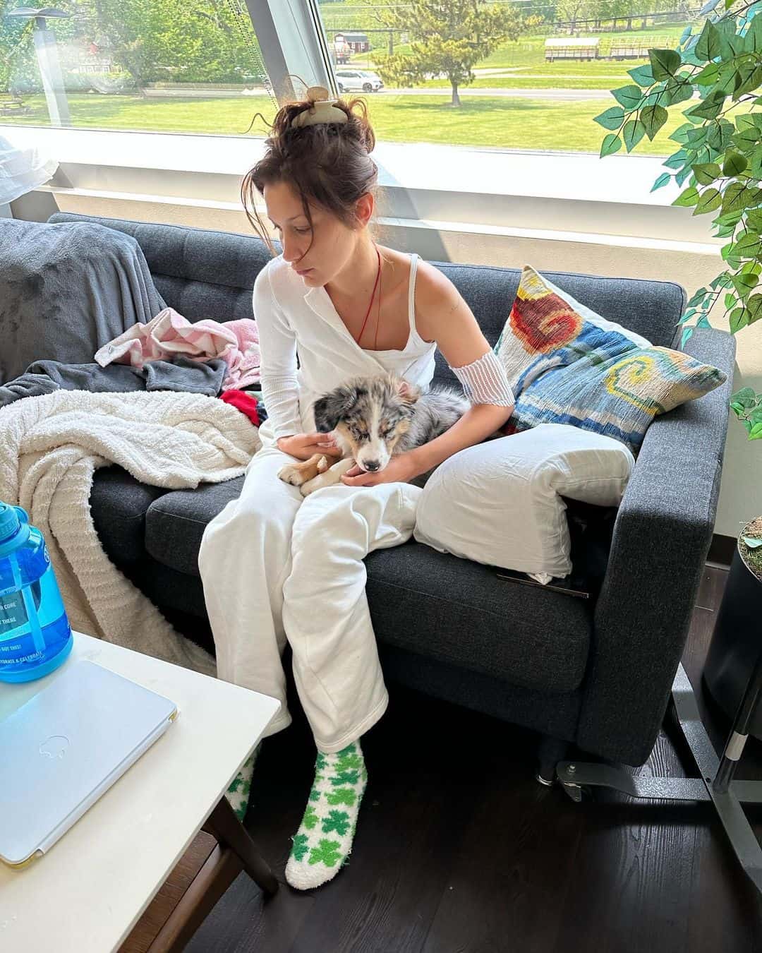 مرض بيلا حديد