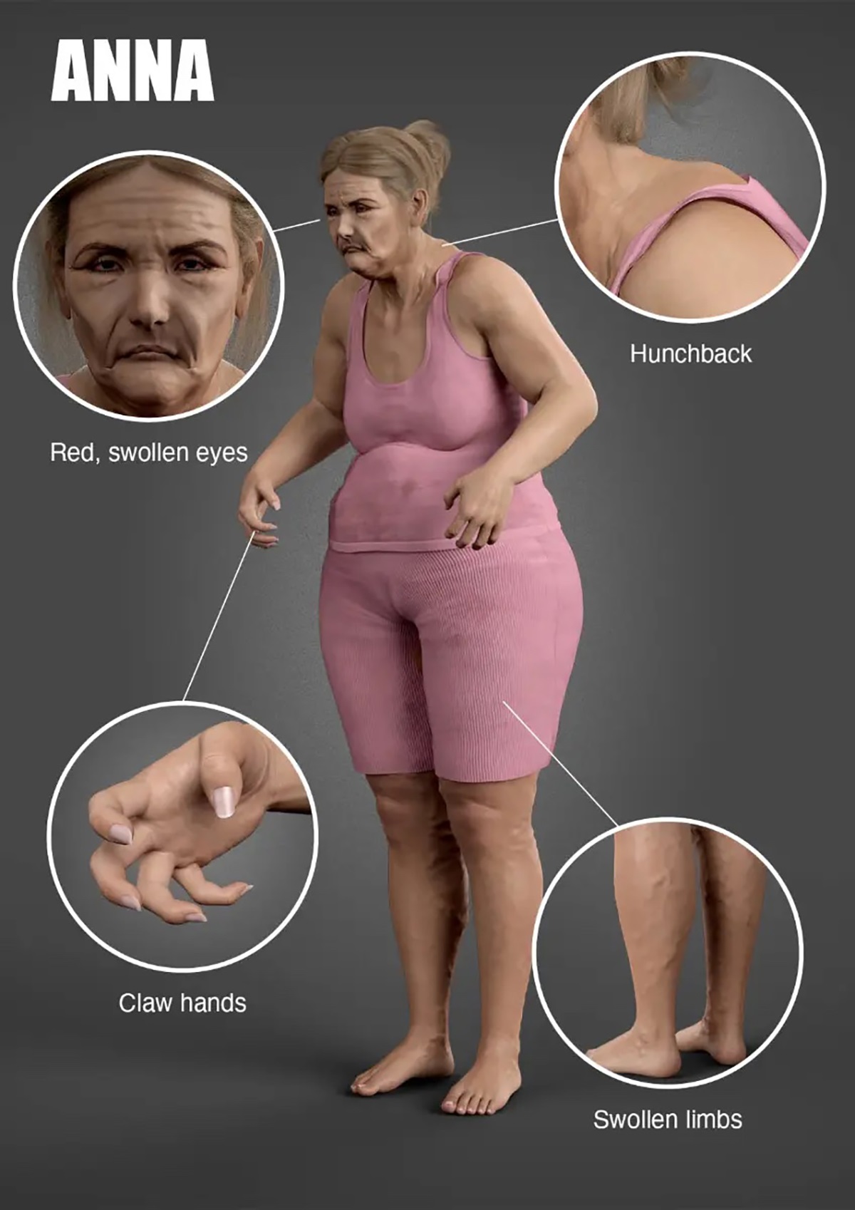 العمل عن بعد يسبب زيادة الوزن ومشاكل في الصحة العقلية