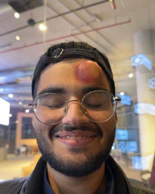 صور مزعومة على أنها لآثار تسديدة رونالدو التي ارتطمت بالمصور السعودي