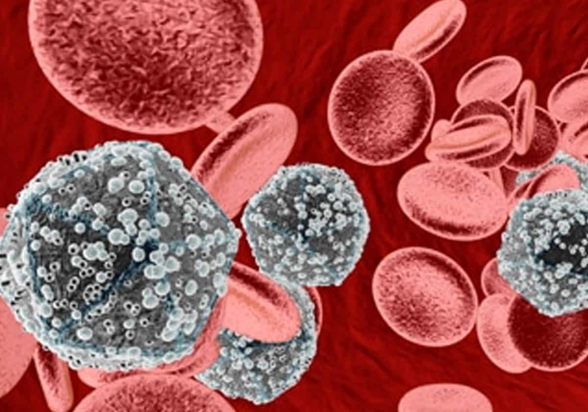 متلازمة النقص المناعي المكتسب