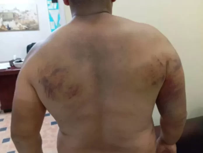 تعذيب فلسطيني على يد جنود ومستوطنين