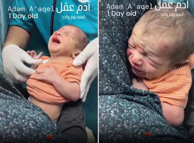 إصابة طفل فلسطيني عمره يومه بقصف إسرائيلي