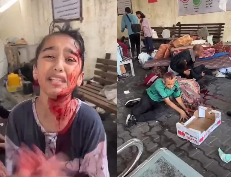 مصابون وجرحى في القصف الذي استهدف مستشفى الشفاء