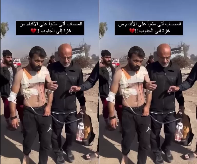 جريح أجبره الاحتلال على النزوح من شمال غزة لجنوبها سيرا على الأقدام