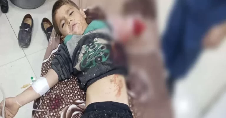 سوريا.. أسد يغافل طفل يلعب بجوار القفص ويلتهم ذراعه (شاهد) أسد يلتهم يد طفل سوري