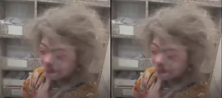 طفلة من ذوي الاحتياجات الخاصة مصابة في قصف إسرائيلي على غزة